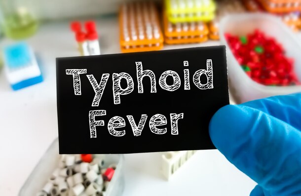 typhoid table image
